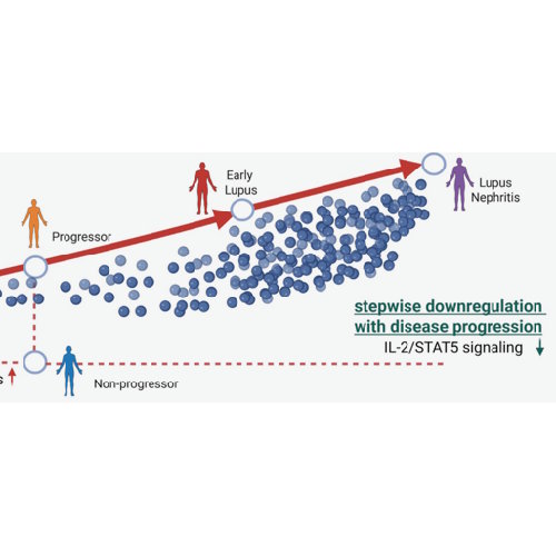 Research by Sofia Papanikolaou from the Nikolaou lab identifies the early immune warning signs that signal the development of Systemic Lupus Erythematosus (SLE).