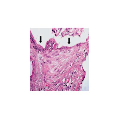 The lab expands its experimental toolkit for studying fibrosis and the autotaxin–lysophosphatidic acid (LPA) signaling axis, bringing together tissue-based models, biochemical assays, and mouse genetics.